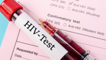 Zimbabwe Ranks The 5th Countries With The Highest HIV Rates In 2025