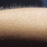 What Causes Goosebumps, And Why