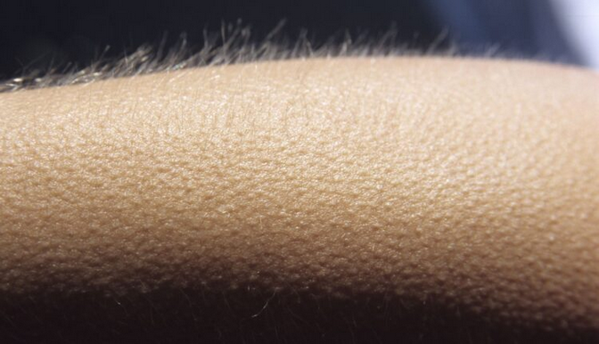 What Causes Goosebumps, And Why