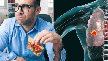 Notice This Symptoms While Eating? It Could Signal Cancer - Doctors Warn