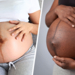 Why Do Black Lines Appear On Pregnant Women’s Stomachs, And What Do They Do