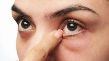 8 Tips On How To Improve The Look Of Your Under-eyes