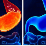 Effects Of Skip Breakfast On Your Body
