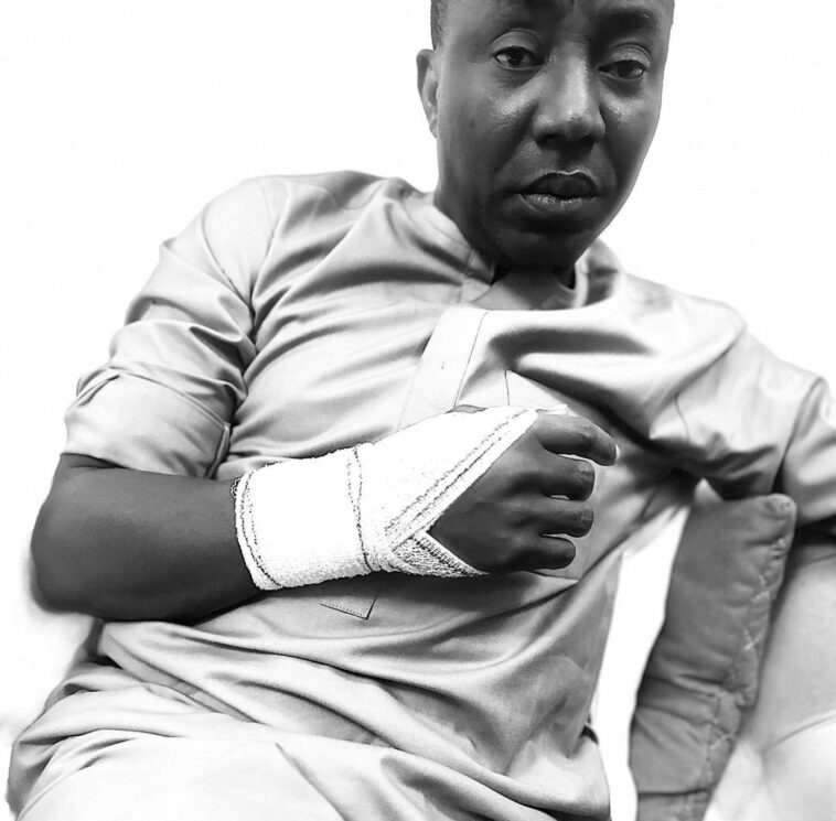 IGP Monitoring Unit Allegedly Breaks Omoyele Sowore’s Arm During Forceful Transfer (PHOTOS)