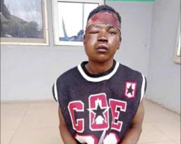 Suspected Thief Escapes Lynching For Attacking Man Who Caught Him (PHOTOS)