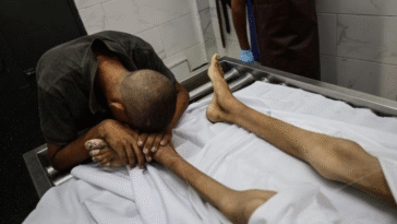 BREAKING: Palestinian Boy, 17, Dies Of Israel-induced Starvation in Gaza
