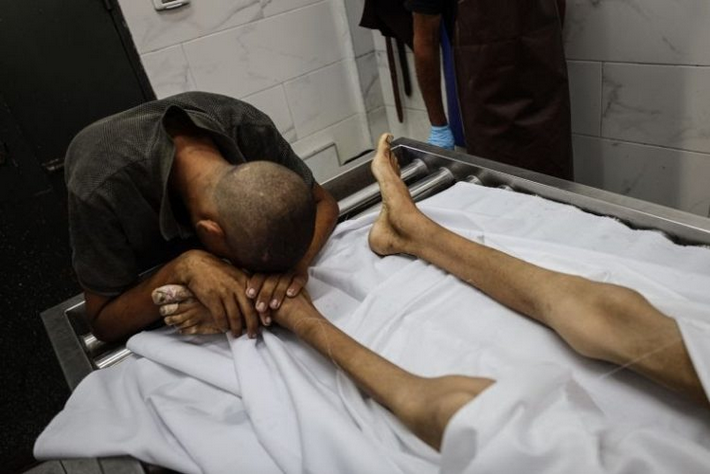 BREAKING: Palestinian Boy, 17, Dies Of Israel-induced Starvation in Gaza